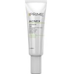 ژل پوست های آکنه دار پریم حجم 30 میلی لیتر _ PRIME